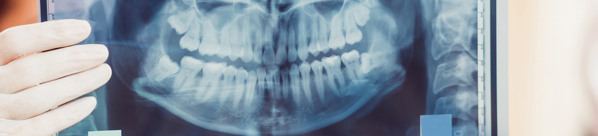 Innovative Oral Surgery