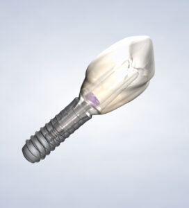 single tooth Dental Implants