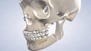 facial trauma dental procedures