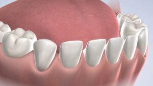 pediatric oral surgery