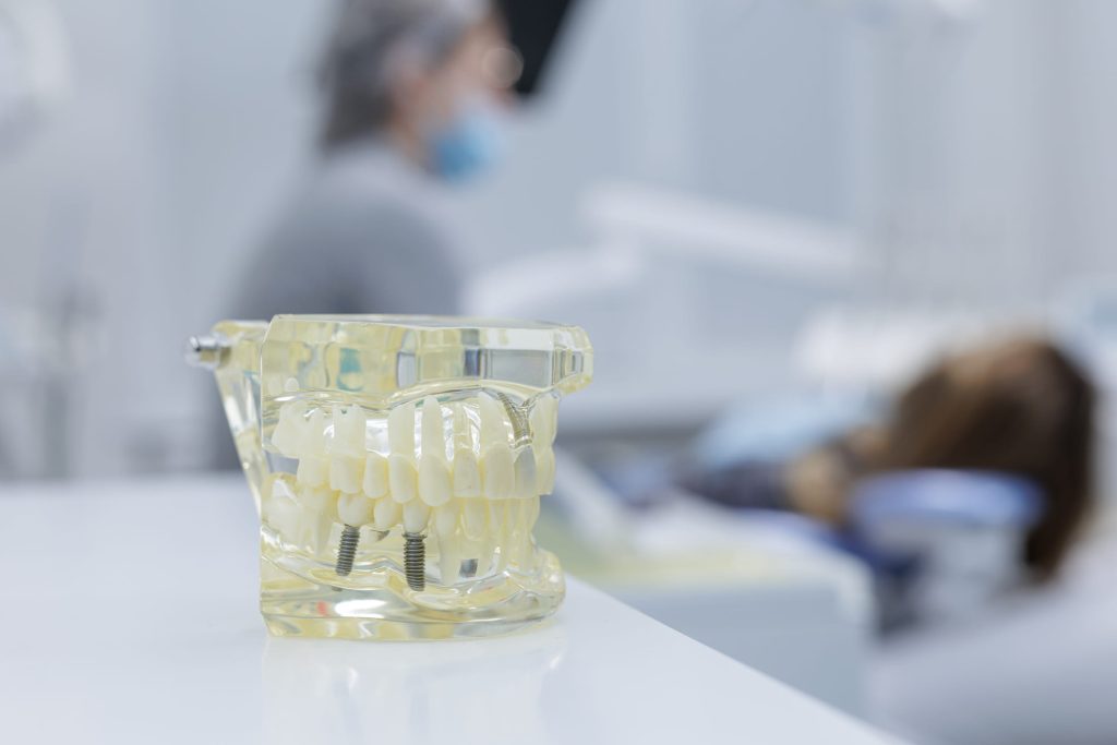 Clear jaw model with dental implants on a counter while a dentist treats a patient
